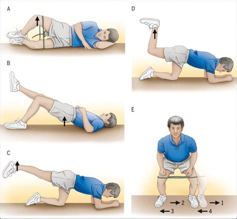 Gluteus Minimus Strengthening Exercises