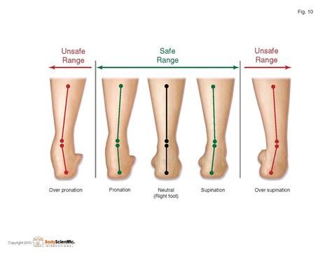 Supination vs. Pronation (plantar) Morton's Neuroma, Foot Exercises ...