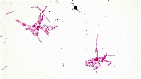 Bacillus Cereus Gram Stain