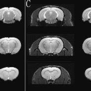 (PDF) A Rat Brain MRI Template with Digital Stereotaxic Atlas of Fine ...