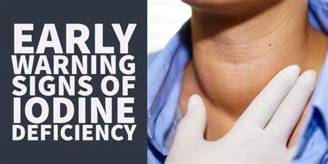 Early Signs Of Iodine Deficiency How It Affects Your, 41% OFF