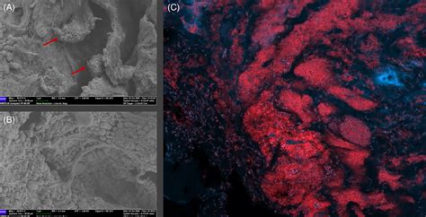 Microscopy of select patient samples to illustrate the confirmed ...