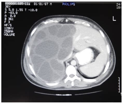 Medicina | Free Full-Text | Reaching the Challenging Diagnosis of ...