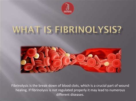 What is Fibrinolysis? | PPT