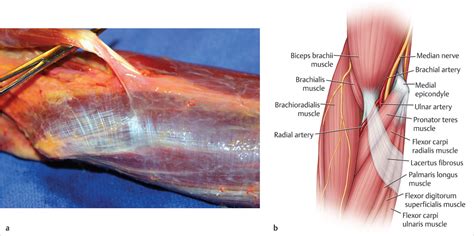 15 The Forearm Fascia and Retinacula | Musculoskeletal Key