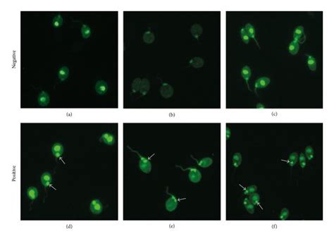 Immunofluorescence patterns on Crithidia luciliae revealing the absence ...