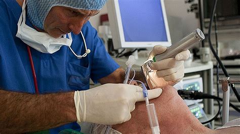 Research Story Tip: Short Periods of Intubation During Surgery May ...