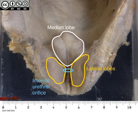 Prostate Anatomy Lobes