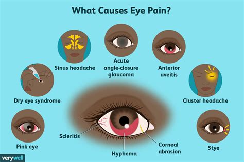 Eye Pain Causes Treatment And When To See A Doctor