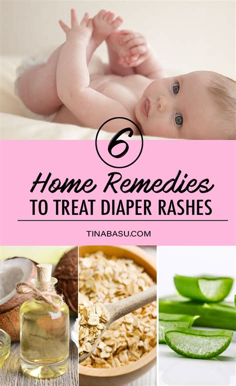 6 Effective Home Remedies to Treat Diaper Rash In Babies #babycare