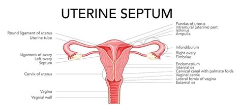 Septate Uterus (Uterine Septum): Symptoms Treatment, 59% OFF