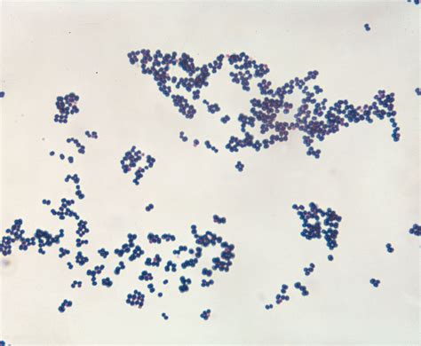 Staphylococcus aureus | Characteristics, Infections, Transmission ...