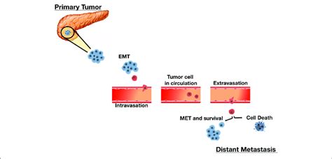 | The Sequential Process of Cancer Metastasis. Metastasis is a complex ...