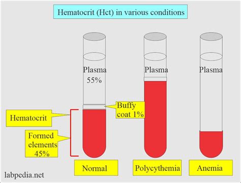 Hemoglobin:- Part 4 - Hematocrit (Hct), Packed Cell Volume (PCV ...