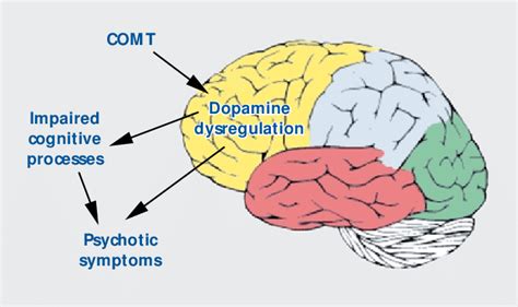 Schematic representation of the putative effect of a schizophrenia ...