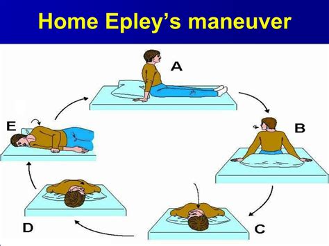 Epley Maneuver Diagram