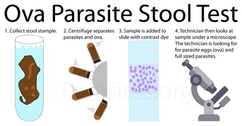 Ova Parasite Hocker (Poop) Test | Constant Reader