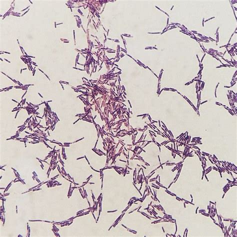 “B.cereus positive gram stain #bacteria #แบคทีเรีย #Bacillus” Bacillus ...