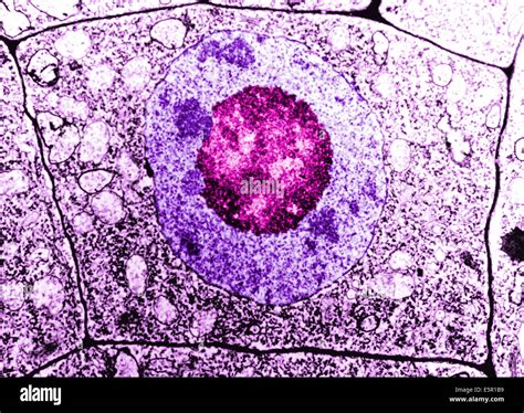 Electron Microscopy of a normal human cell, The cell membrane, nucleus ...