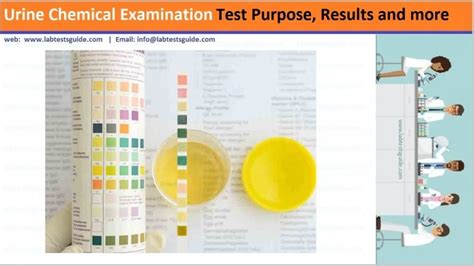 Urine Urobilinogen Test Purpose, | Lab Tests Guide