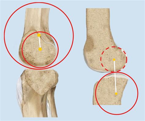 The difference in "convex" and "concave". - Josh's Knee Blog