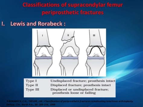 Periprosthetic fractures around the knee