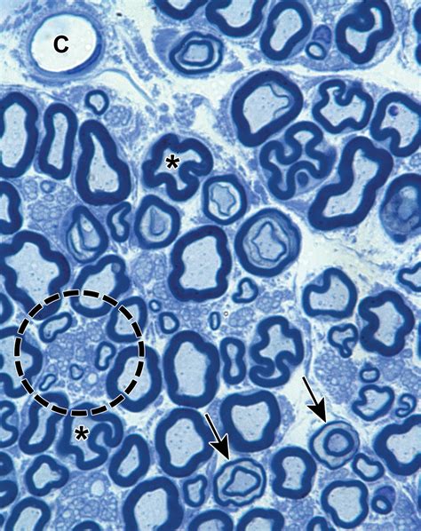 Atlas of Normal Microanatomy, Procedural and Processing Artifacts ...