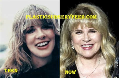 Stevie Nicks Plastic Surgery - Plastic Surgery Feed