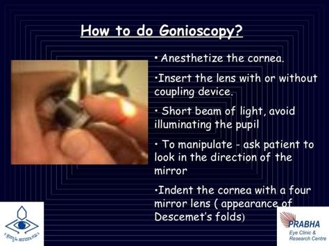 19 gonioscopy