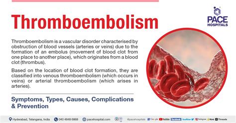 Thromboembolism - Symptoms, Types, Causes & Prevention