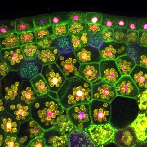 Image of stained plant tissue that was captured using a fluorescence ...