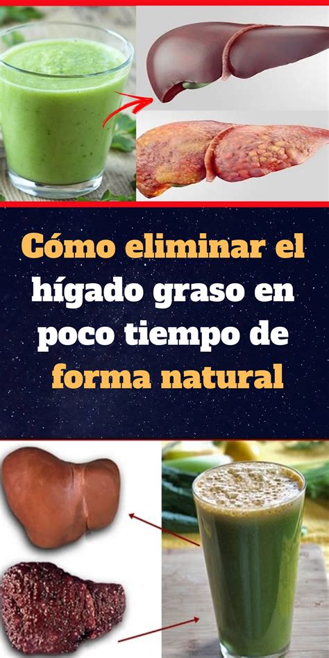 Cómo eliminar el hígado graso en poco tiempo de forma natural | Dieta ...