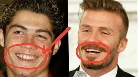 Celebrities With Braces Before And After, Metal Mouth Throwback Photos ...