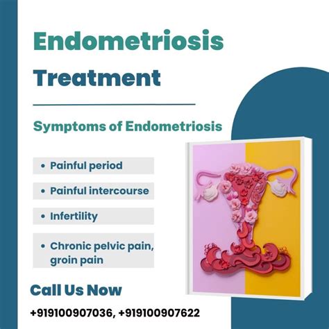 Endometriosis Treatment, Symptoms and Diagnosis | Medintu