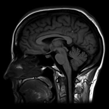 Brain Magnetic Resonance Imaging Technique: Approach Considerations, In ...