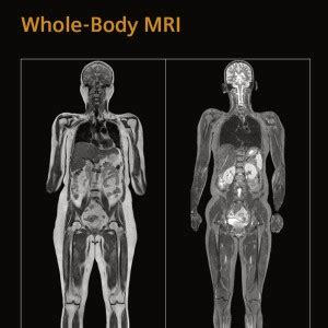 Full Body MRI in less than 10 minutes — Oakland MRI