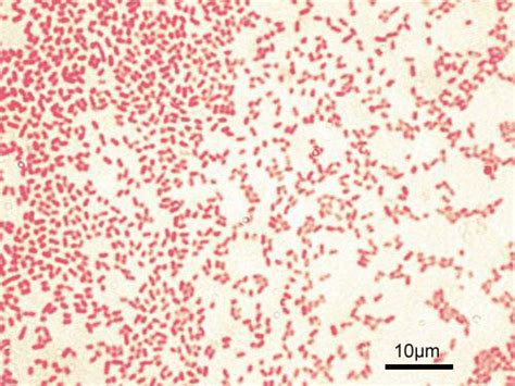 [Figure, Microscopic image of gram-negative Pseudomonas ...