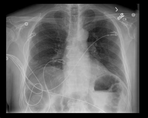 On Call Radiology - common radiology findings on call and in the ...