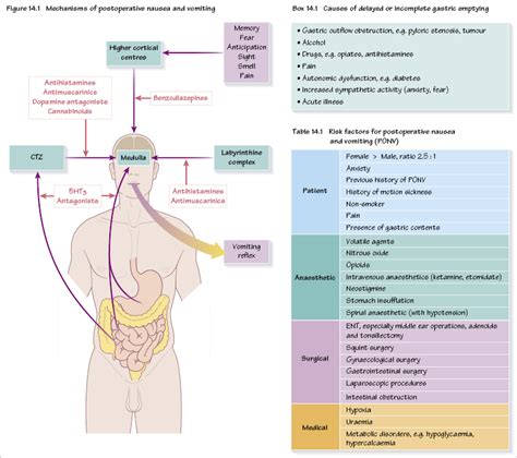 14: Postoperative nausea and vomiting | Pocket Dentistry