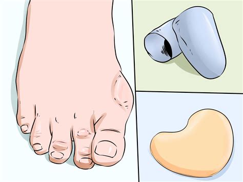 3 Ways to Prevent Calluses on Hands - wikiHow