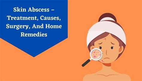 Skin Abscess Treatment At Home: Skin Abscess Treatment, Its Causes ...