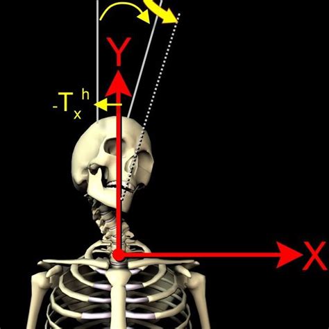 Patients primary abnormal posture subluxations are shown. The patients ...