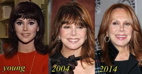 Marlo Thomas Plastic surgery for 76 year old!