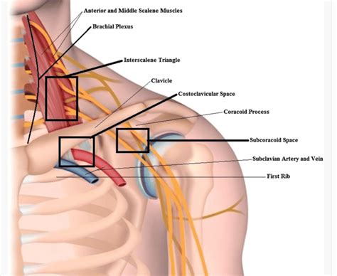 Thoracic Outlet Syndrome - Symptoms, Causes & Types