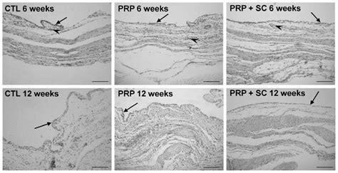 Representative view of synovial membrane histology from experimental ...