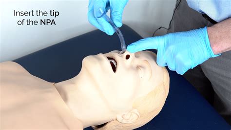 Nasopharyngeal Airway Sizes