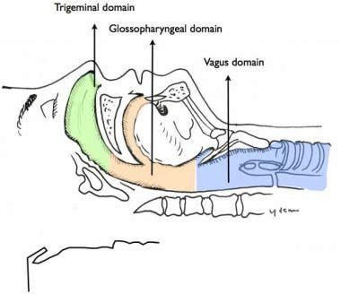 Local Anesthesia of the Airway Technique: Approach Considerations ...