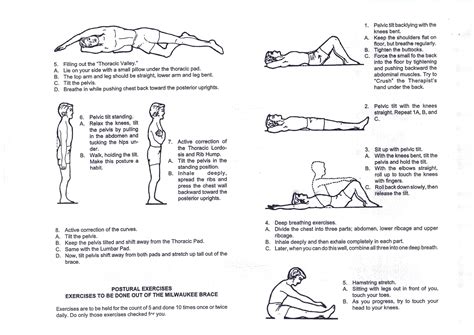 Scoliosis Exercises | Scolisos | Pinterest | Scoliosis exercises ...