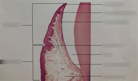 Histology of gingiva Diagram | Quizlet