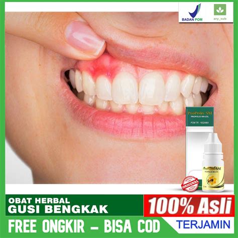 Jual Obat Gusi Bengkak - Ngilu - Sakit Gigi - Obat Infeksi Radang Gusi ...